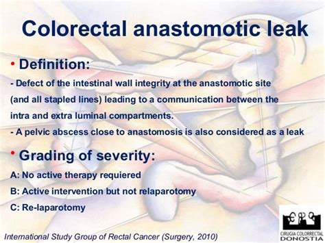 asssthetic leak|Anastomotic Leak: Symptoms, Treatment & What It Is